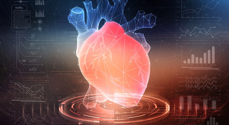 CareDx To Acquire TransChart